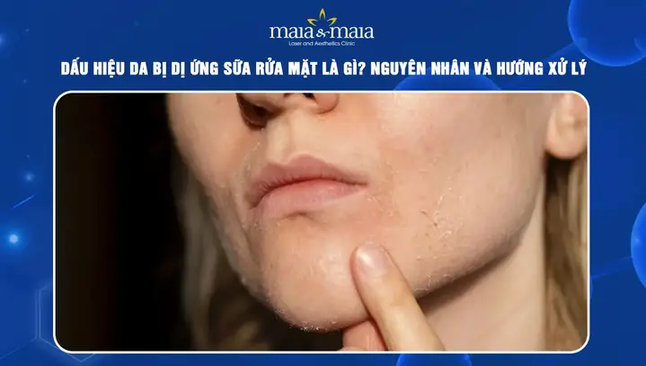 Dị Ứng Sữa Rửa Mặt: Nhận Biết, Xử Lý Nhanh Và Cách Phòng Tránh Hiệu Quả Dị Ứng Sữa Rửa Mặt: Nhận Biết, Xử Lý Nhanh Và Cách Phòng Tránh Hiệu Quả
