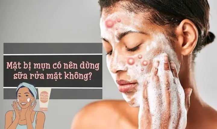 Bị Mụn Có Nên Dùng Sữa Rửa Mặt Không? Nguyên Nhân & Cách Khắc Phục Bị Mụn Có Nên Dùng Sữa Rửa Mặt Không? Nguyên Nhân & Cách Khắc Phục
