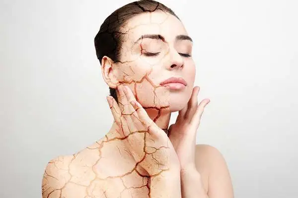 Bị Mụn Có Nên Rửa Mặt Bằng Nước Ấm? Giải Đáp Chi Tiết Từ Chuyên Gia Bị Mụn Có Nên Rửa Mặt Bằng Nước Ấm? Giải Đáp Chi Tiết Từ Chuyên Gia