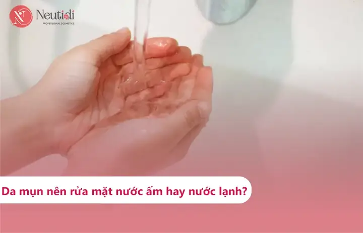 Bị Mụn Có Nên Rửa Mặt Bằng Nước Ấm? Giải Đáp Chi Tiết Từ Chuyên Gia Bị Mụn Có Nên Rửa Mặt Bằng Nước Ấm? Giải Đáp Chi Tiết Từ Chuyên Gia