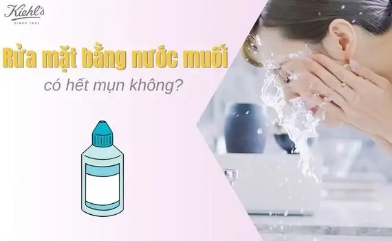 Cách Rửa Mặt Bằng Nước Muối Trị Mụn: Hướng Dẫn Chi Tiết & Lưu Ý Cách Rửa Mặt Bằng Nước Muối Trị Mụn: Hướng Dẫn Chi Tiết & Lưu Ý