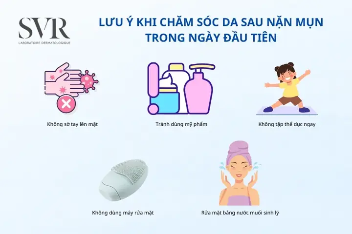 Hướng Dẫn Chi Tiết Cách Rửa Mặt Sau Khi Nặn Mụn Và Chăm Sóc Da An Toàn