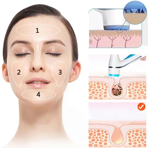 Cách Sử Dụng Máy Rửa Mặt Nu Skin Lumispa Hiệu Quả Cho Làn Da Tươi Sáng Cách Sử Dụng Máy Rửa Mặt Nu Skin Lumispa Hiệu Quả Cho Làn Da Tươi Sáng