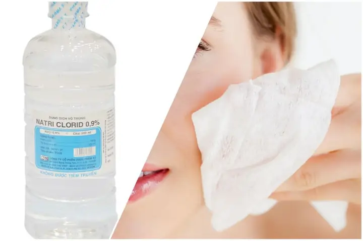 Cách Sử Dụng Nước Muối Sinh Lý Rửa Mặt Đúng Cách Và Các Lưu Ý Quan Trọng