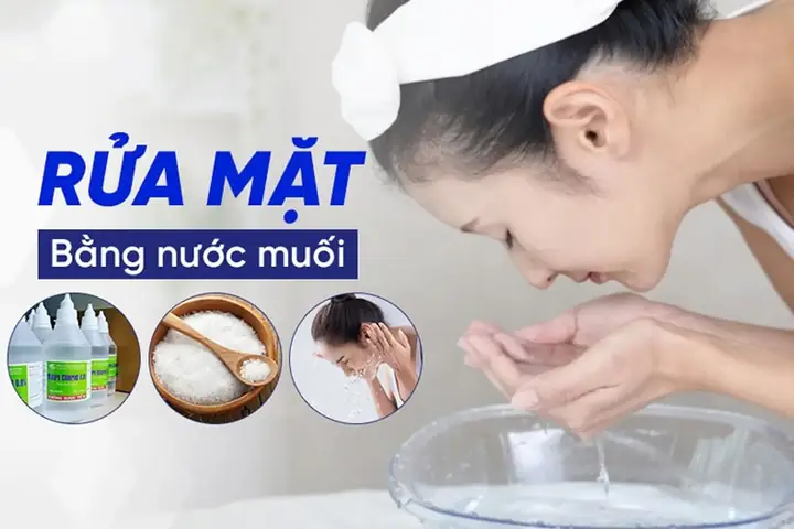 Có Nên Rửa Mặt Bằng Nước Muối Sinh Lý Không? Lợi Ích Và Lưu Ý Cần Biết Có Nên Rửa Mặt Bằng Nước Muối Sinh Lý Không? Lợi Ích Và Lưu Ý Cần Biết