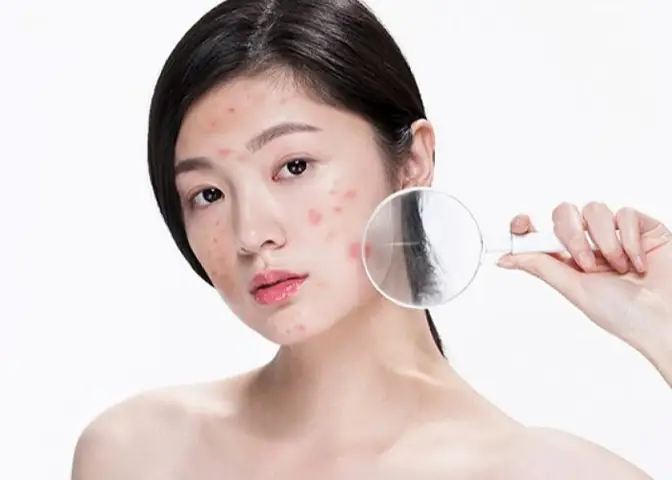 Rửa Mặt Bằng Cồn Có Tốt Không? Tác Hại Và Cách Xử Lý An Toàn Cho Da