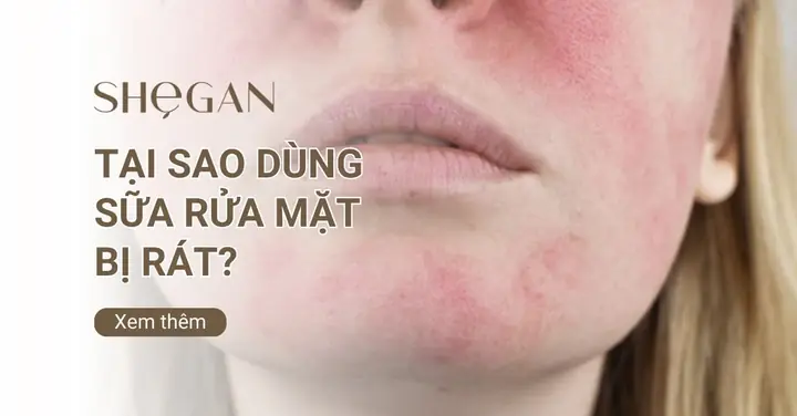 Da Bị Rát Sau Khi Rửa Mặt: Nguyên Nhân & Cách Khắc Phục Tình Trạng Khó Chịu Da Bị Rát Sau Khi Rửa Mặt: Nguyên Nhân & Cách Khắc Phục Tình Trạng Khó Chịu