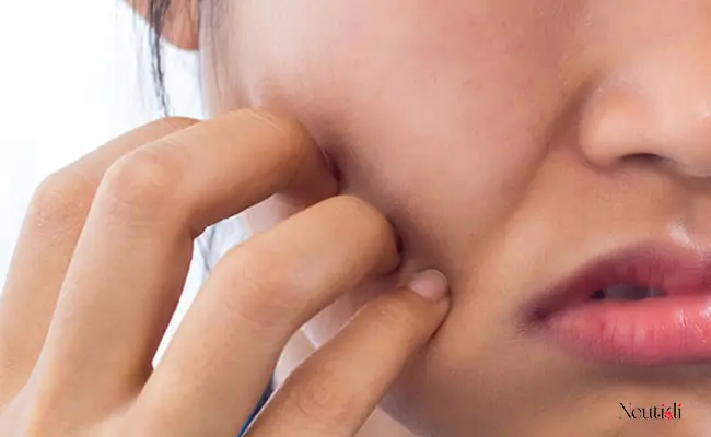 Da Mặt Bị Ngứa Sau Khi Rửa Mặt: Nguyên Nhân & Cách Xử Lý Hiệu Quả
