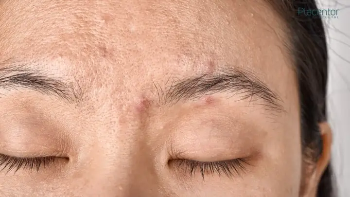 Dấu Hiệu Nhận Biết Và Cách Xử Lý Khi Bị Dị Ứng Sữa Rửa Mặt Dấu Hiệu Nhận Biết Và Cách Xử Lý Khi Bị Dị Ứng Sữa Rửa Mặt