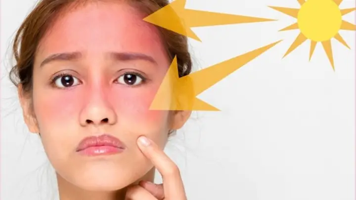 Đi Nắng Về Có Nên Rửa Mặt Ngay Lập Tức Không? Chuyên Gia Giải Đáp Đi Nắng Về Có Nên Rửa Mặt Ngay Lập Tức Không? Chuyên Gia Giải Đáp