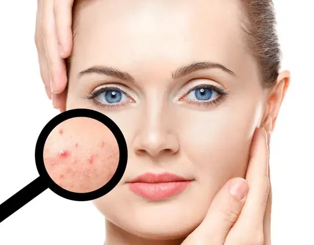 Sữa Rửa Mặt Có Tác Dụng Gì? Lợi Ích, Cách Dùng Đúng & Lưu Ý Quan Trọng Sữa Rửa Mặt Có Tác Dụng Gì? Lợi Ích, Cách Dùng Đúng & Lưu Ý Quan Trọng