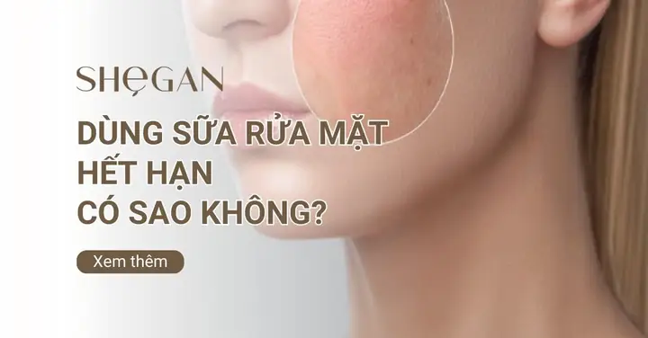 Dùng Sữa Rửa Mặt Hết Hạn Có Sao Không? Tác Hại & Cách Xử Lý An Toàn Dùng Sữa Rửa Mặt Hết Hạn Có Sao Không? Tác Hại & Cách Xử Lý An Toàn