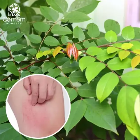 Lá Khế Rửa Mặt: Công Dụng, Cách Làm Và Lưu Ý Để Đẹp Da Toàn Diện Lá Khế Rửa Mặt: Công Dụng, Cách Làm Và Lưu Ý Để Đẹp Da Toàn Diện