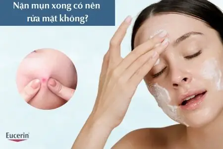 Lột Mụn Xong Có Nên Rửa Mặt Ngay? Hướng Dẫn Chăm Sóc Da Chi Tiết Lột Mụn Xong Có Nên Rửa Mặt Ngay? Hướng Dẫn Chăm Sóc Da Chi Tiết