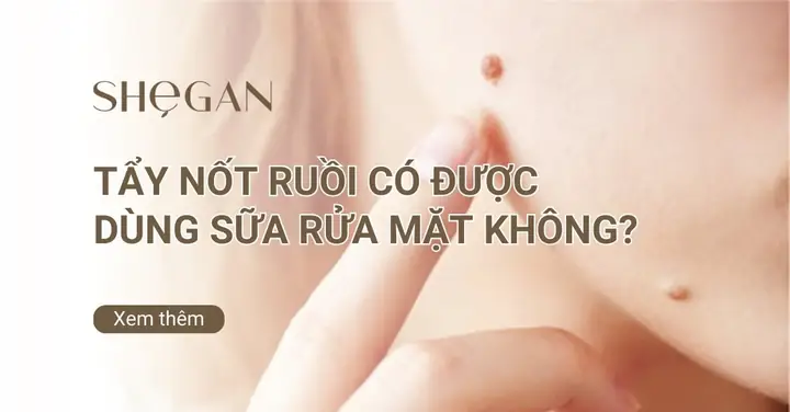 Mới Tẩy Nốt Ruồi Có Được Rửa Mặt Không? Thời Gian Kiêng Và Cách Chăm Sóc Mới Tẩy Nốt Ruồi Có Được Rửa Mặt Không? Thời Gian Kiêng Và Cách Chăm Sóc