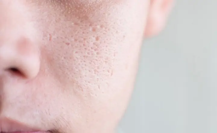 Nam Có Dùng Được Sữa Rửa Mặt Của Nữ Không? Giải Đáp Từ Chuyên Gia
