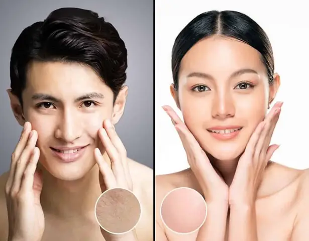 Nam Giới Có Nên Dùng Sữa Rửa Mặt Không? Hướng Dẫn Chọn Sản Phẩm Phù Hợp Nam Giới Có Nên Dùng Sữa Rửa Mặt Không? Hướng Dẫn Chọn Sản Phẩm Phù Hợp