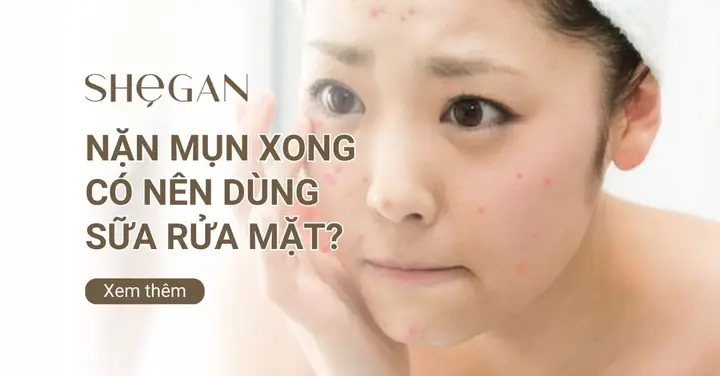 Nặn Mụn Xong Có Nên Dùng Sữa Rửa Mặt Không? Lưu Ý Quan Trọng Nặn Mụn Xong Có Nên Dùng Sữa Rửa Mặt Không? Lưu Ý Quan Trọng