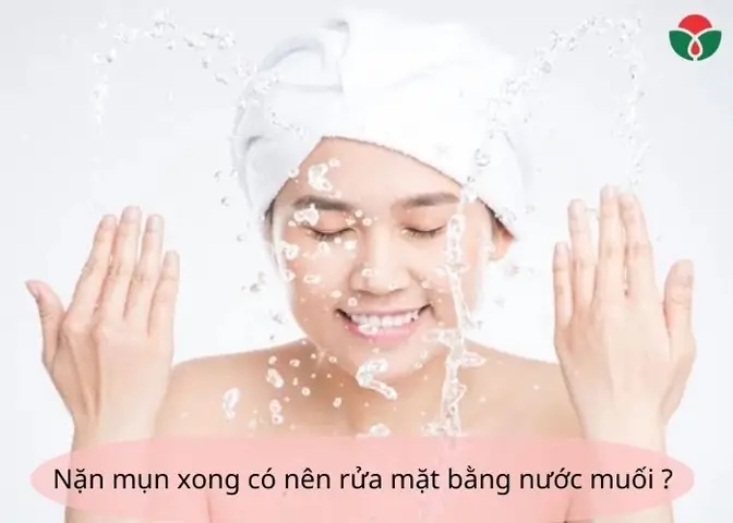 Nặn Mụn Xong Có Nên Rửa Mặt Bằng Nước Muối Sinh Lý Không?