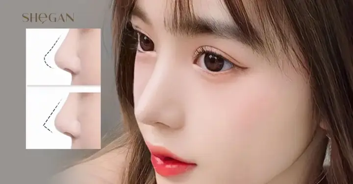 Nâng Mũi Bao Lâu Thì Được Rửa Mặt Và Chăm Sóc Da Đúng Cách?