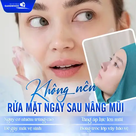 Nâng Mũi Bao Lâu Thì Rửa Mặt Được? Hướng Dẫn Chăm Sóc An Toàn Nâng Mũi Bao Lâu Thì Rửa Mặt Được? Hướng Dẫn Chăm Sóc An Toàn