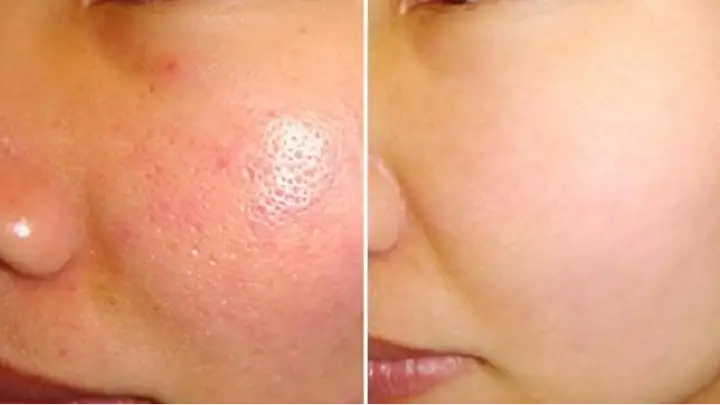 Nên Rửa Mặt Bằng Gì Để Da Sạch Sâu & Khỏe Mạnh? (không Cần Sữa Rửa Mặt) Nên Rửa Mặt Bằng Gì Để Da Sạch Sâu & Khỏe Mạnh? (không Cần Sữa Rửa Mặt)