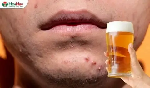 Rửa Mặt Bằng Bia Có Sao Không? Tác Dụng, Cách Thực Hiện Và Lưu Ý Rửa Mặt Bằng Bia Có Sao Không? Tác Dụng, Cách Thực Hiện Và Lưu Ý
