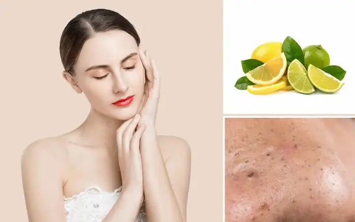 Rửa Mặt Bằng Chanh: Hướng Dẫn Chi Tiết & Những Lưu Ý Quan Trọng Để Da Sáng Mịn An Toàn Rửa Mặt Bằng Chanh: Hướng Dẫn Chi Tiết & Những Lưu Ý Quan Trọng Để Da Sáng Mịn An Toàn