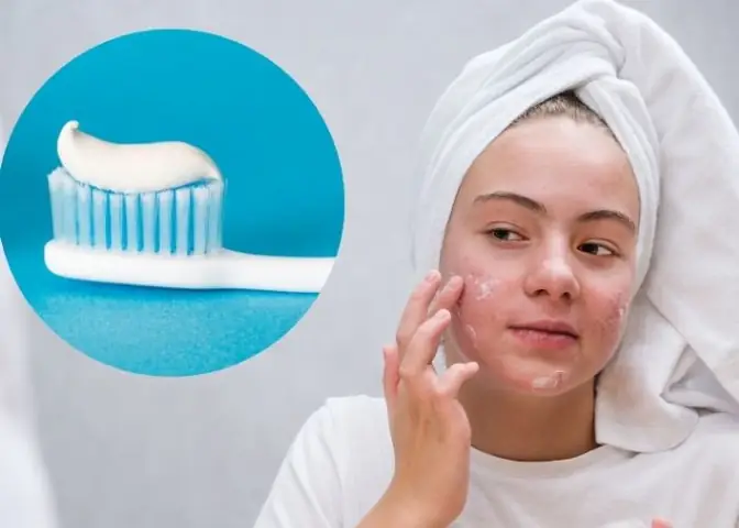 Rửa Mặt Bằng Kem Đánh Răng Ps Có Tốt Không? Lợi Ích, Rủi Ro Và Lưu Ý Rửa Mặt Bằng Kem Đánh Răng Ps Có Tốt Không? Lợi Ích, Rủi Ro Và Lưu Ý
