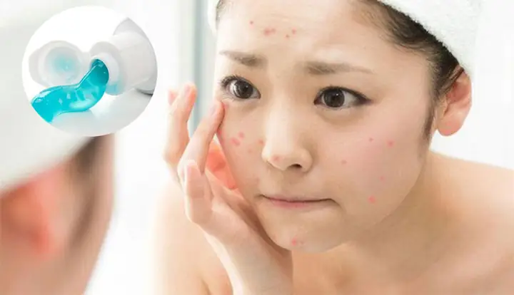 Rửa Mặt Bằng Kem Đánh Răng Và Muối: Có Nên Hay Không Và Cách Thực Hiện An Toàn