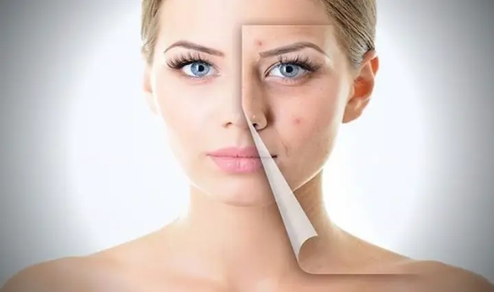 Rửa Mặt Bằng Muối Hột: Có Nên Hay Không Và Cách Thực Hiện Đúng Rửa Mặt Bằng Muối Hột: Có Nên Hay Không Và Cách Thực Hiện Đúng