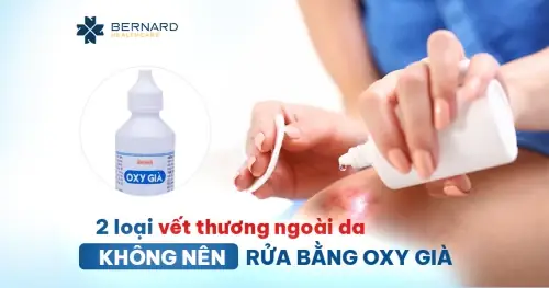 Rửa Mặt Bằng Oxy Già: Có Nên Hay Không? Cách Sử Dụng An Toàn