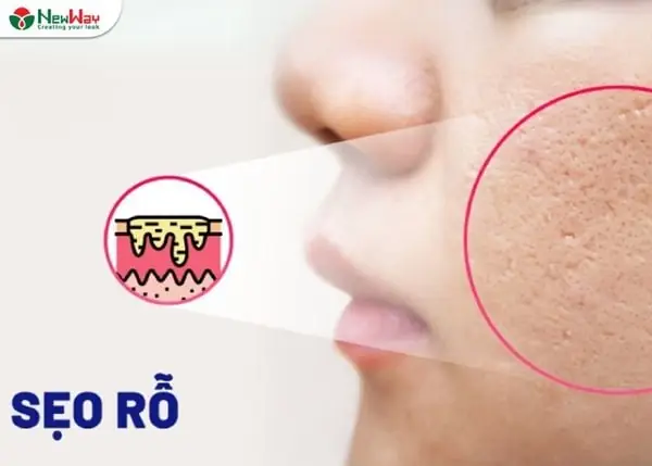 "rửa Mặt Bằng Tăm" Nghĩa Là Gì? Giải Mã Biệt Danh & Lời Khuyên Chăm Sóc Da Đúng Cách