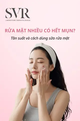 Rửa Mặt Nhiều Có Hết Mụn Không? Tần Suất Đúng & Cách Chăm Sóc Da Mụn Hiệu Quả