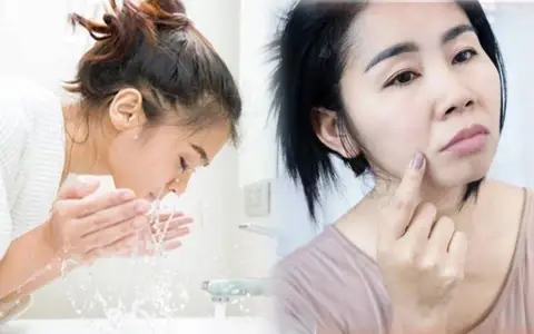 10 Sai Lầm Thường Gặp Khi Rửa Mặt Và Cách Khắc Phục Hiệu Quả 10 Sai Lầm Thường Gặp Khi Rửa Mặt Và Cách Khắc Phục Hiệu Quả