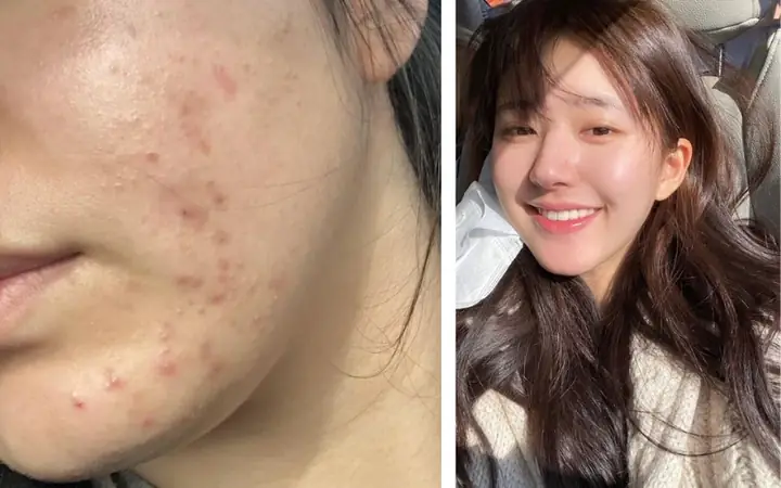 Rửa Mặt Lúc Nào Là Tốt Nhất? Khung Giờ Vàng & Cách Chăm Sóc Da Hiệu Quả
