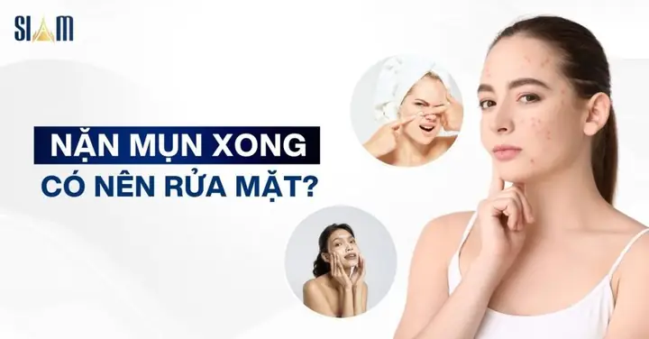 Sau Khi Nặn Mụn Có Nên Rửa Mặt Không? Hướng Dẫn Chăm Sóc Da Đúng Cách Sau Khi Nặn Mụn Có Nên Rửa Mặt Không? Hướng Dẫn Chăm Sóc Da Đúng Cách