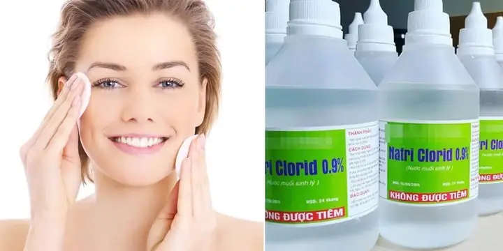 Rửa Mặt Bằng Nước Muối Sinh Lý: Tác Dụng, Cách Thực Hiện Và Lưu Ý An Toàn Rửa Mặt Bằng Nước Muối Sinh Lý: Tác Dụng, Cách Thực Hiện Và Lưu Ý An Toàn
