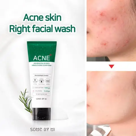 Top 10 Sữa Rửa Mặt Acne Hàn Quốc Tốt Nhất: Hướng Dẫn Chọn & Review Chi Tiết Top 10 Sữa Rửa Mặt Acne Hàn Quốc Tốt Nhất: Hướng Dẫn Chọn & Review Chi Tiết