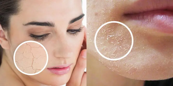 Sữa Rửa Mặt Cho Da Khô Mùa Đông: Chọn Loại Nào Dịu Nhẹ, Cấp Ẩm Tối Ưu? Sữa Rửa Mặt Cho Da Khô Mùa Đông: Chọn Loại Nào Dịu Nhẹ, Cấp Ẩm Tối Ưu?