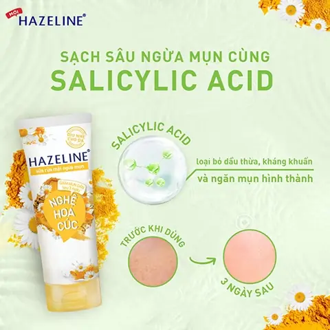Sữa Rửa Mặt Hazeline Kem Nghệ: Công Dụng, Thành Phần Và Cách Chọn Sữa Rửa Mặt Hazeline Kem Nghệ: Công Dụng, Thành Phần Và Cách Chọn