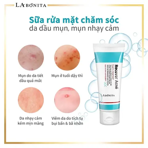 Sữa Rửa Mặt Recover Skin: Công Dụng, Thành Phần Và Chọn Lựa Phù Hợp