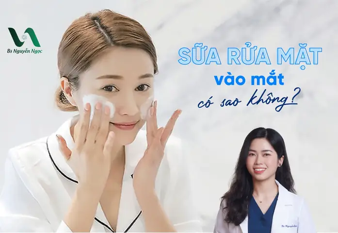 Sữa Rửa Mặt Vào Mắt: Cách Xử Lý An Toàn Và Các Lưu Ý Quan Trọng