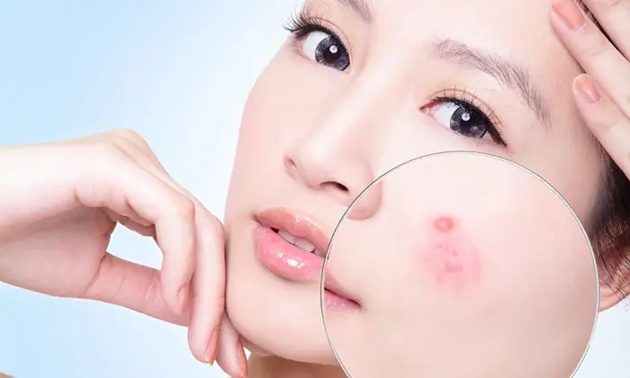 Tại Sao Nên Rửa Mặt Bằng Sữa Rửa Mặt Để Làn Da Khỏe Mạnh? Tại Sao Nên Rửa Mặt Bằng Sữa Rửa Mặt Để Làn Da Khỏe Mạnh?