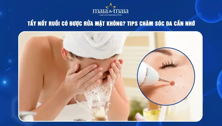 Tẩy Nốt Ruồi Bao Lâu Thì Được Rửa Mặt? Thời Gian Kiêng & Chăm Sóc Tẩy Nốt Ruồi Bao Lâu Thì Được Rửa Mặt? Thời Gian Kiêng & Chăm Sóc