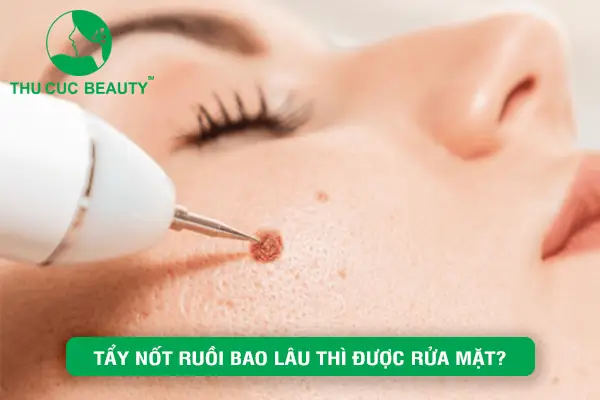 Tẩy Nốt Ruồi Bao Lâu Thì Được Rửa Mặt? Thời Gian Kiêng & Chăm Sóc Tẩy Nốt Ruồi Bao Lâu Thì Được Rửa Mặt? Thời Gian Kiêng & Chăm Sóc