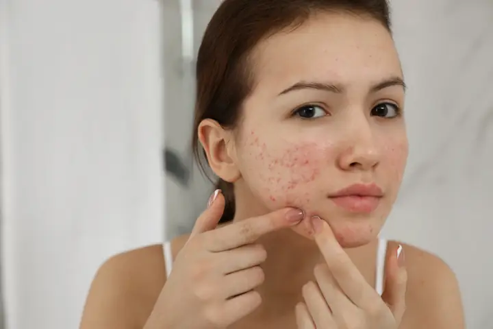 Tẩy Trang Xong Có Cần Rửa Mặt Lại Không? Giải Đáp Chi Tiết Từ Chuyên Gia Tẩy Trang Xong Có Cần Rửa Mặt Lại Không? Giải Đáp Chi Tiết Từ Chuyên Gia