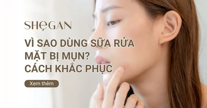 Xài Sữa Rửa Mặt Bị Mụn: Nguyên Nhân, Dấu Hiệu & Cách Khắc Phục Hiệu Quả Xài Sữa Rửa Mặt Bị Mụn: Nguyên Nhân, Dấu Hiệu & Cách Khắc Phục Hiệu Quả