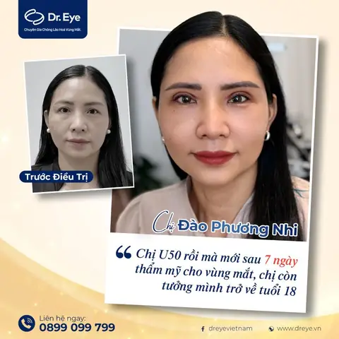 Xăm Lông Mày Bao Lâu Thì Được Rửa Mặt & Chăm Sóc Đúng Cách? Xăm Lông Mày Bao Lâu Thì Được Rửa Mặt & Chăm Sóc Đúng Cách?